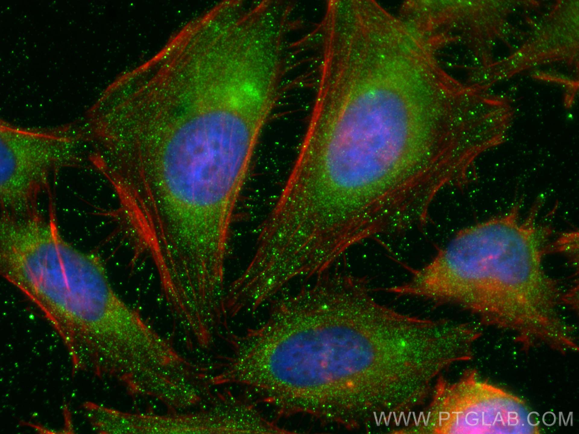 Immunofluorescence (IF) / fluorescent staining of HeLa cells using SEMA3A Polyclonal antibody (27836-1-AP)