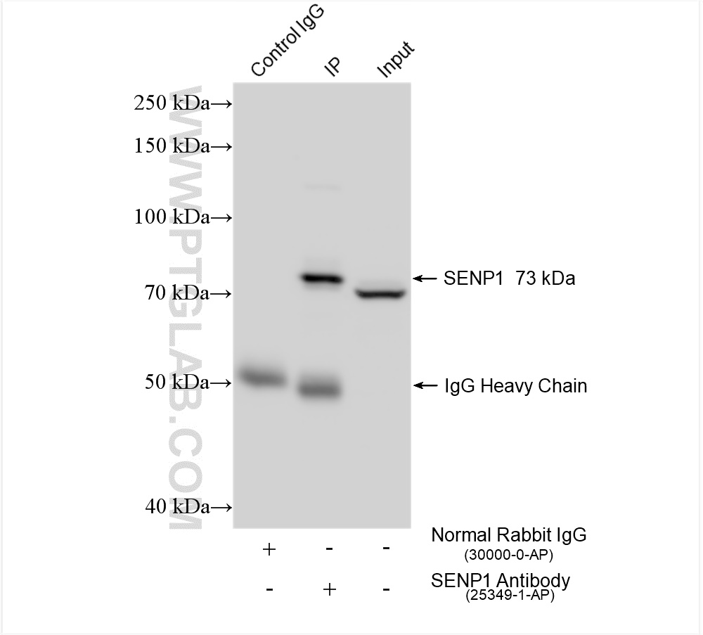Immunoprecipitation (IP) experiment of Jurkat cells using SENP1 Polyclonal antibody (25349-1-AP)