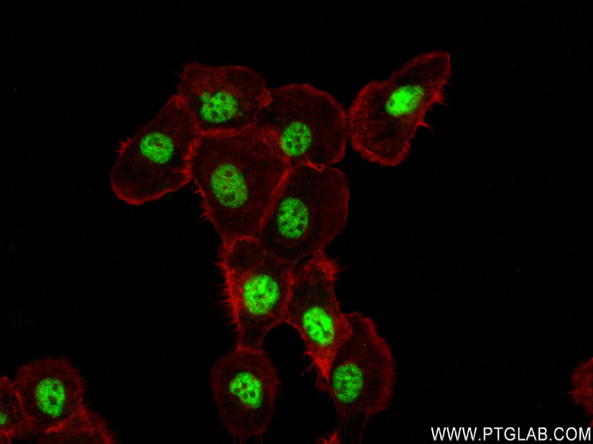 Immunofluorescence (IF) / fluorescent staining of A431 cells using SENP1 Recombinant antibody (83594-1-RR)