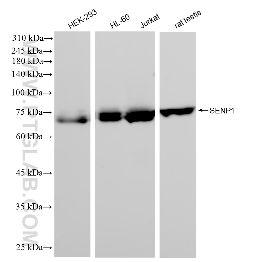 Western Blot (WB) analysis of various lysates using SENP1 Recombinant antibody (83594-4-RR)