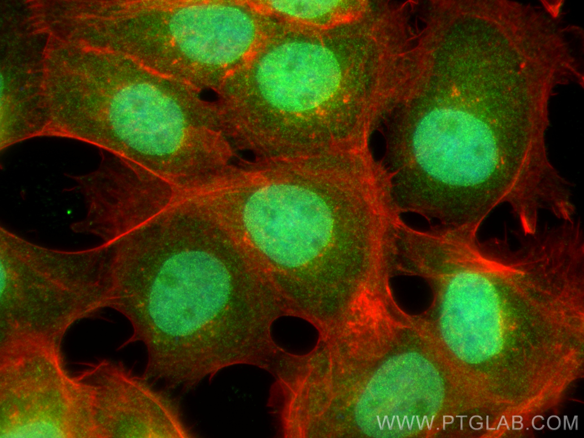 Immunofluorescence (IF) / fluorescent staining of A431 cells using SENP8 Polyclonal antibody (13479-1-AP)