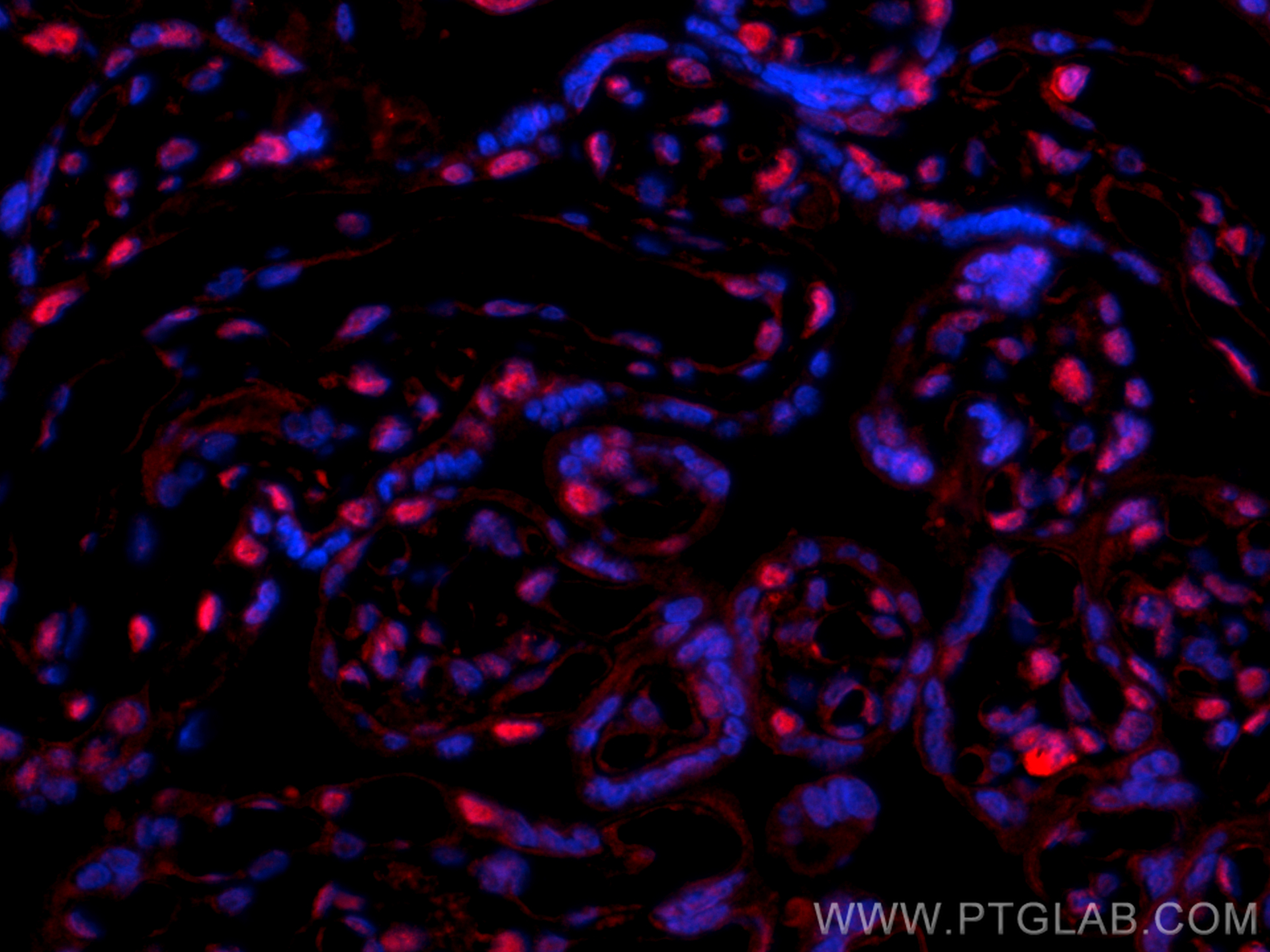 Immunofluorescence (IF) / fluorescent staining of human placenta tissue using SEPHS1 Polyclonal antibody (16635-1-AP)