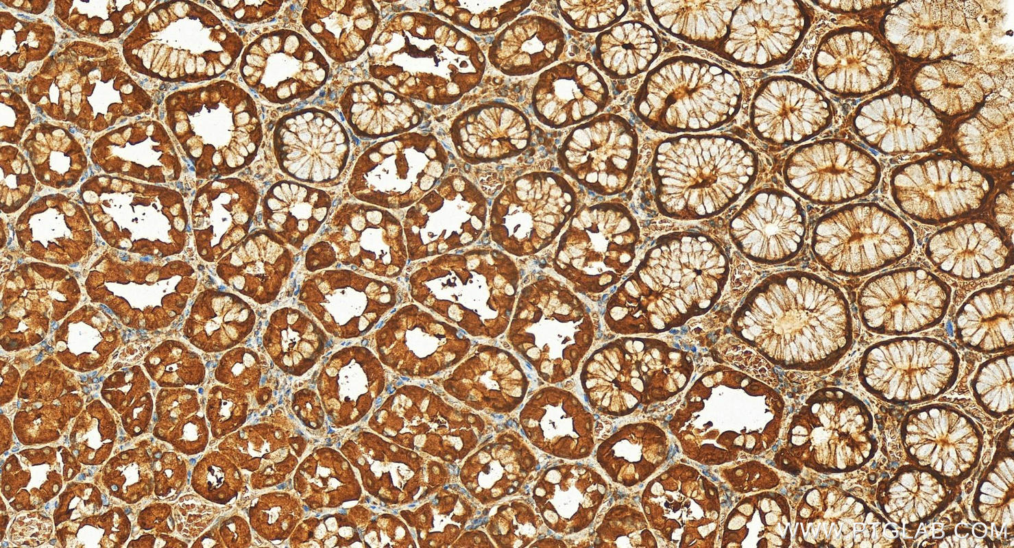 Immunohistochemistry (IHC) staining of human stomach tissue using SLA/LP Polyclonal antibody (11551-1-AP)