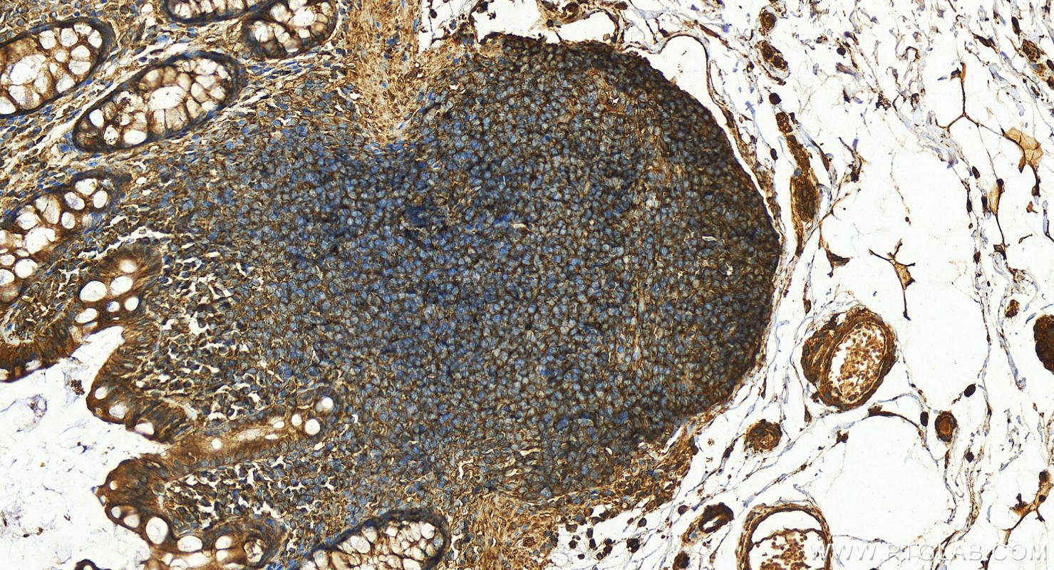 Immunohistochemistry (IHC) staining of human colon tissue using Septin 2 Polyclonal antibody (11397-1-AP)