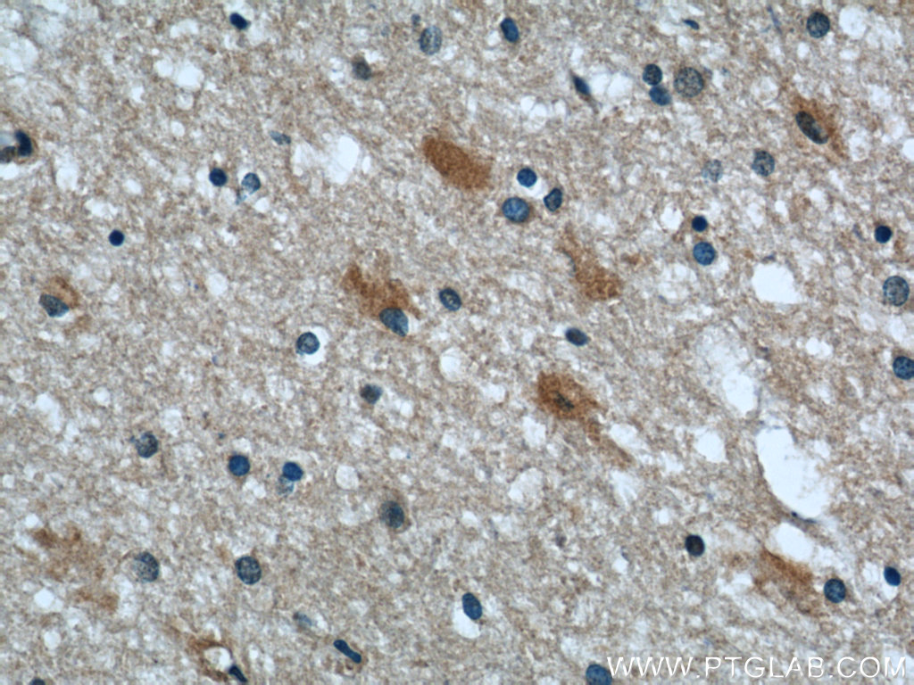 Immunohistochemistry (IHC) staining of human brain tissue using Septin 2 Monoclonal antibody (60075-1-Ig)