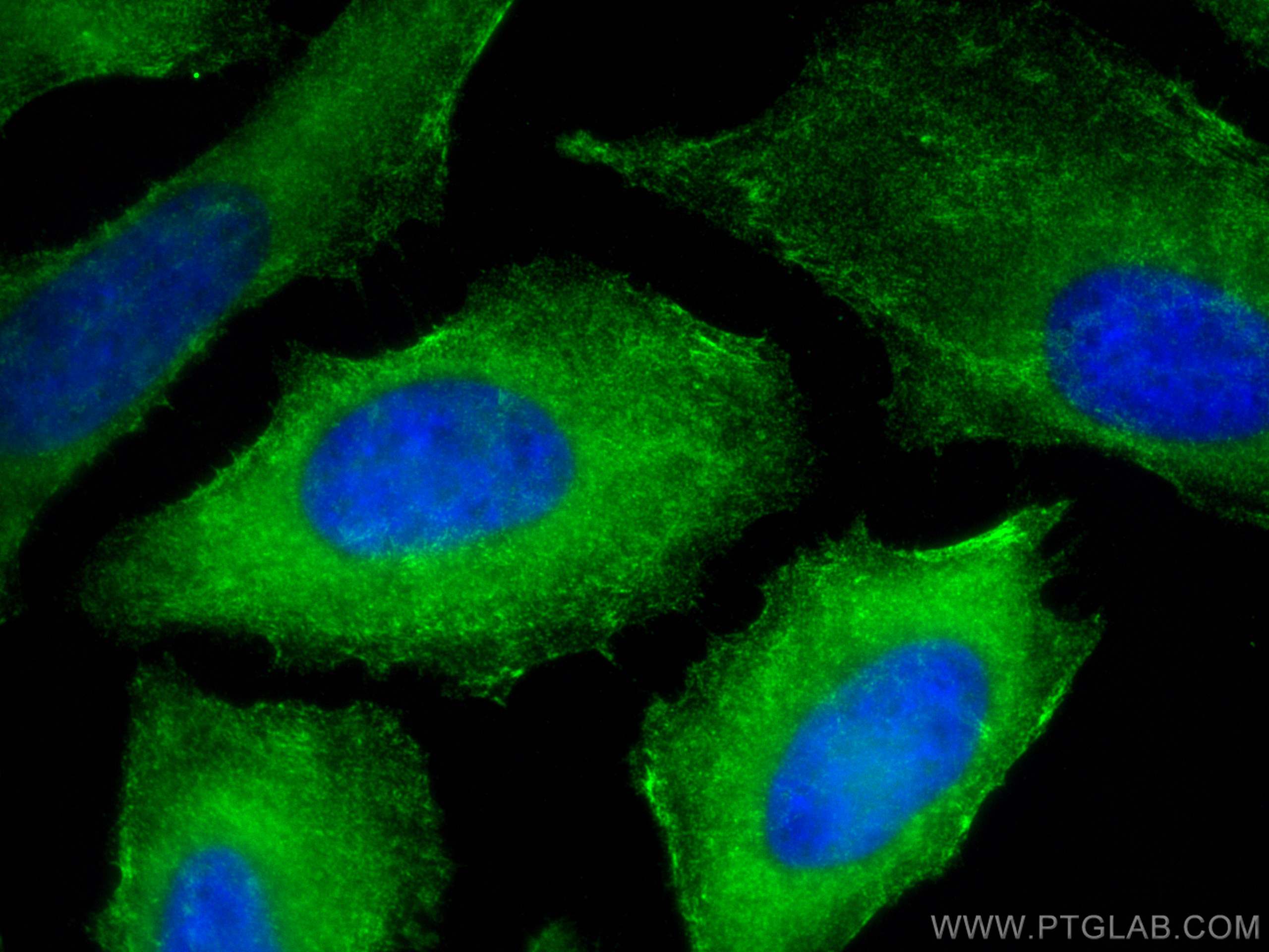 Immunofluorescence (IF) / fluorescent staining of HeLa cells using Septin 9 Polyclonal antibody (10769-1-AP)