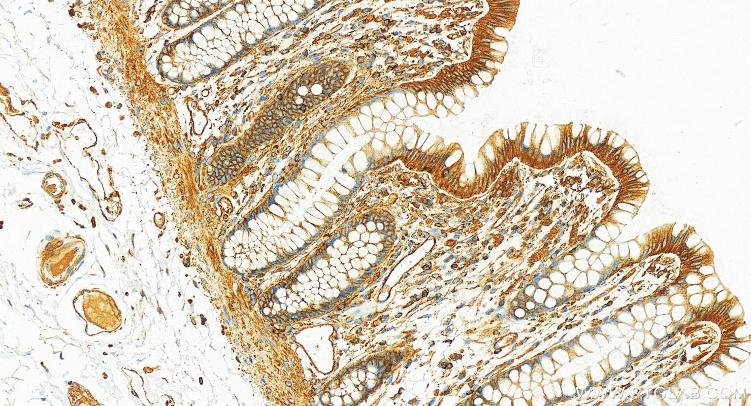 Immunohistochemistry (IHC) staining of human colon tissue using SEPT9 Recombinant antibody (82844-2-RR)