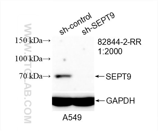 Western Blot (WB) analysis of A549 cells using SEPT9 Recombinant antibody (82844-2-RR)