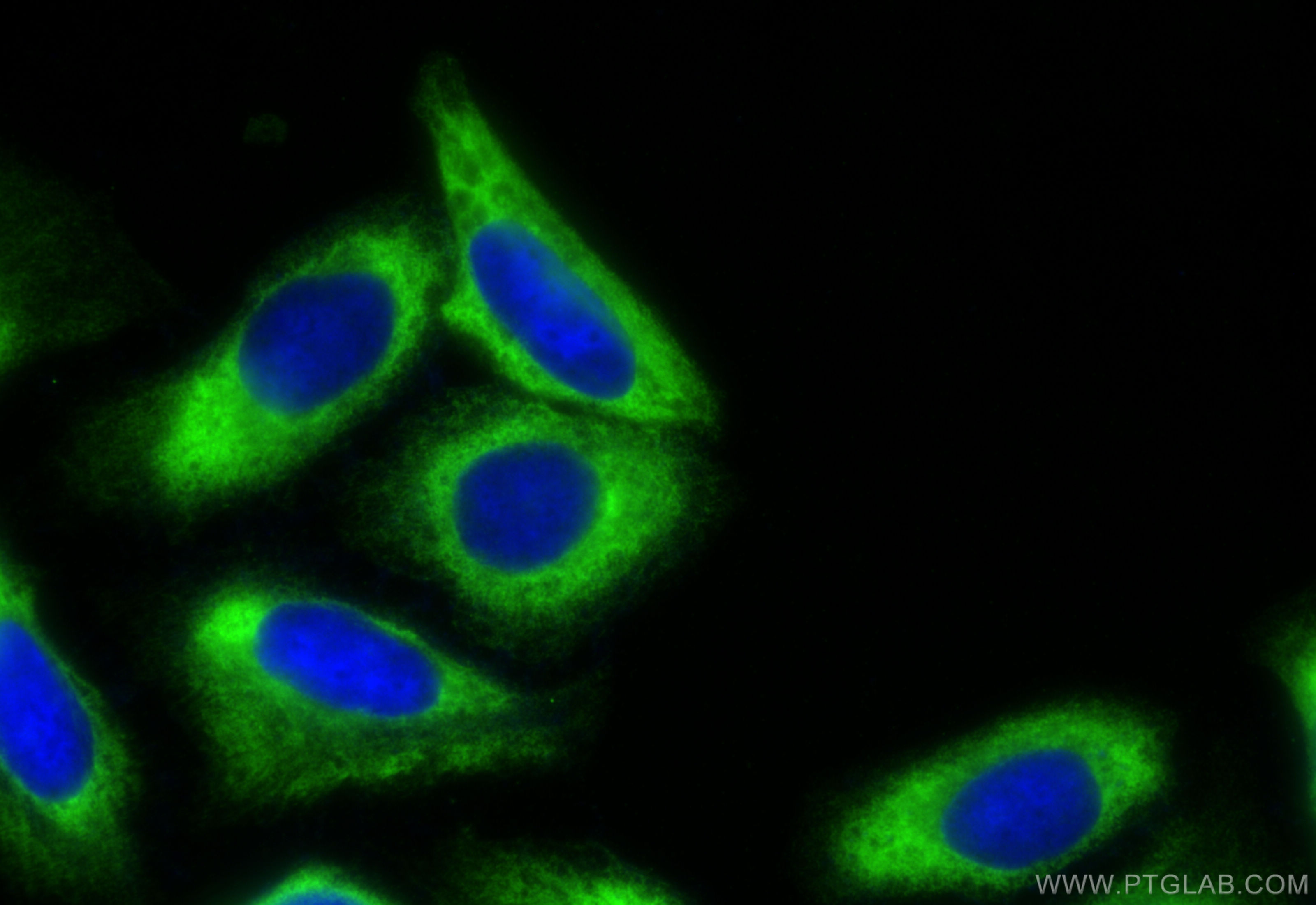 Immunofluorescence (IF) / fluorescent staining of U2OS cells using SERBP1 Polyclonal antibody (10729-1-AP)