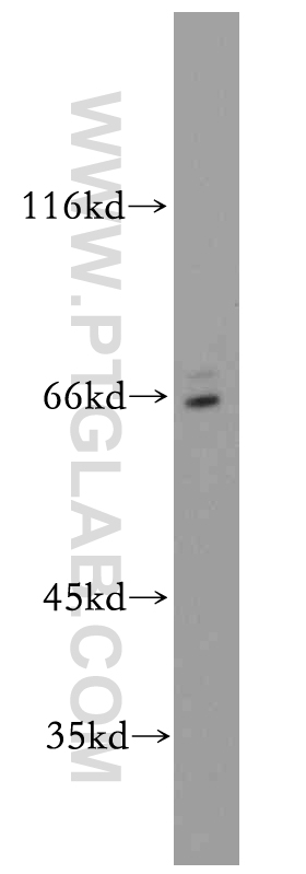 Western Blot (WB) analysis of MCF-7 cells using SERINC2-Specific Polyclonal antibody (20266-1-AP)