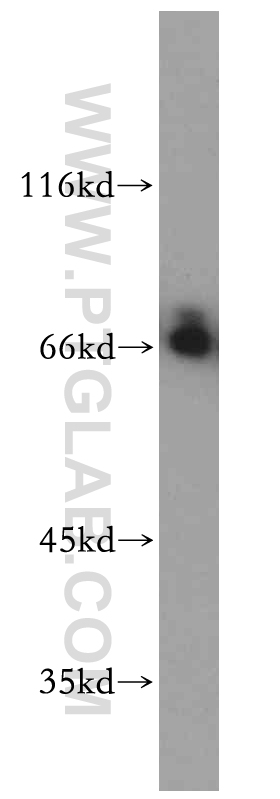 SERINC2-Specific