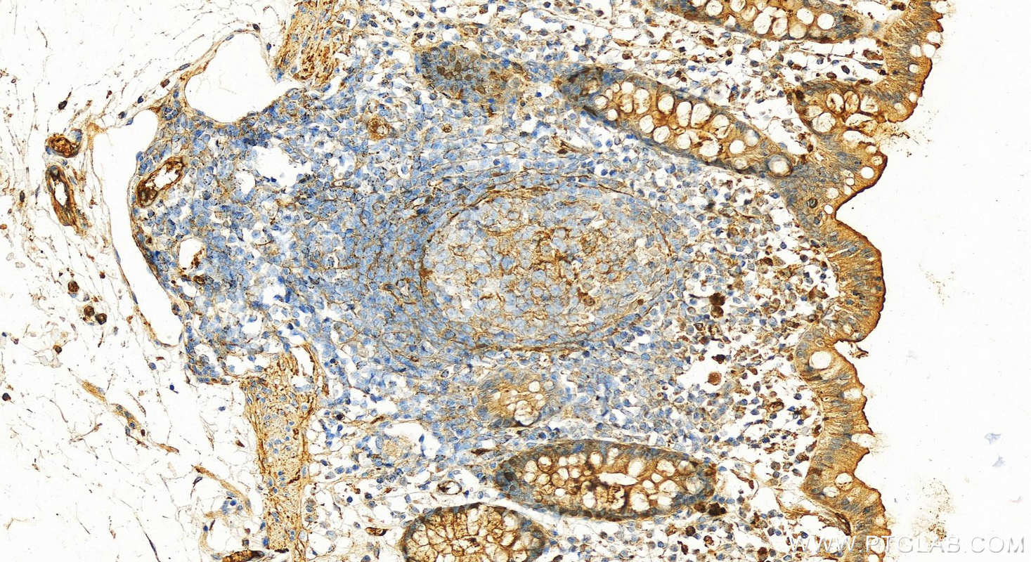 Immunohistochemistry (IHC) staining of human colon tissue using Alpha 1 Antitrypsin Polyclonal antibody (16382-1-AP)