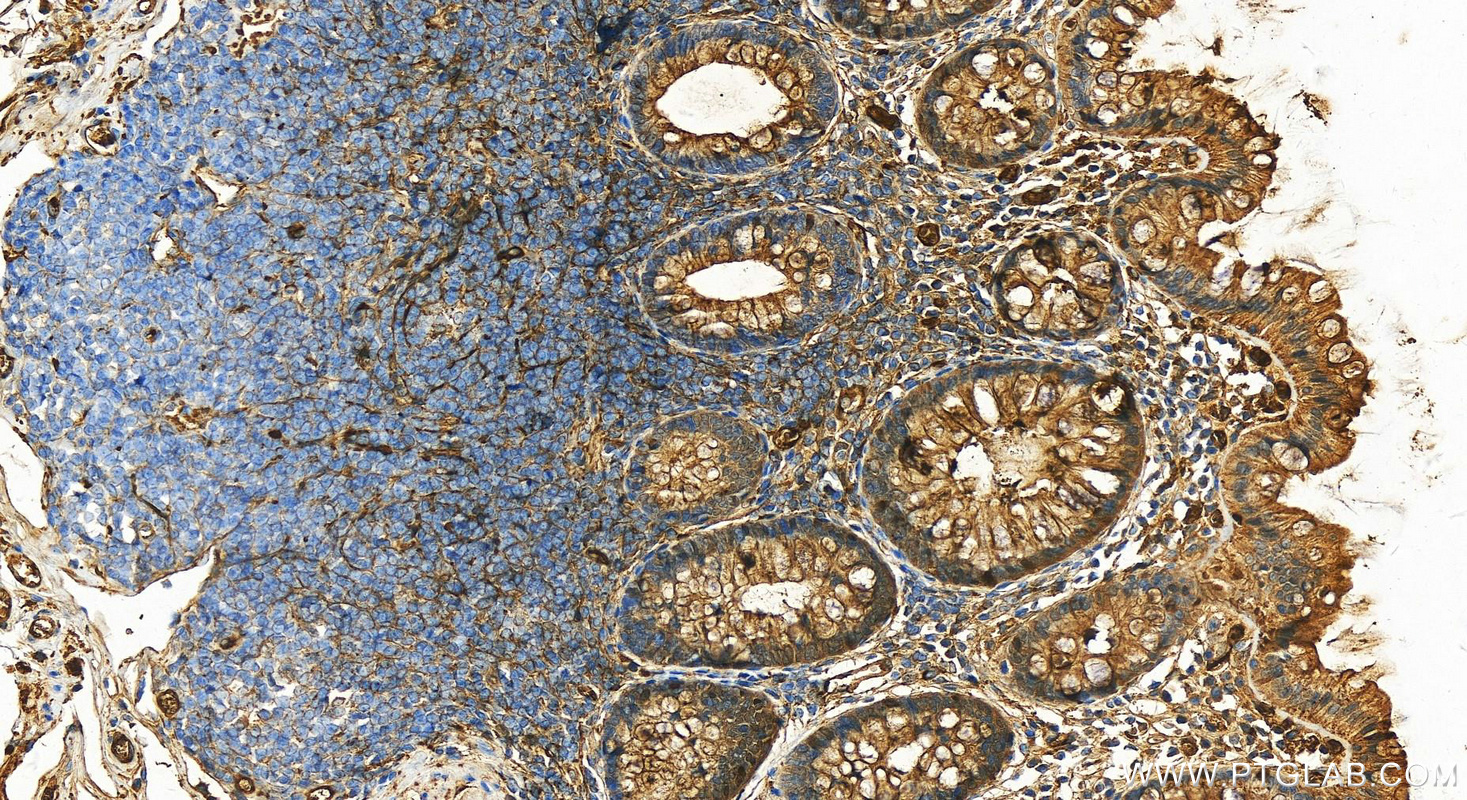 Immunohistochemistry (IHC) staining of human colon tissue using Alpha 1 Antitrypsin Polyclonal antibody (16382-1-AP)