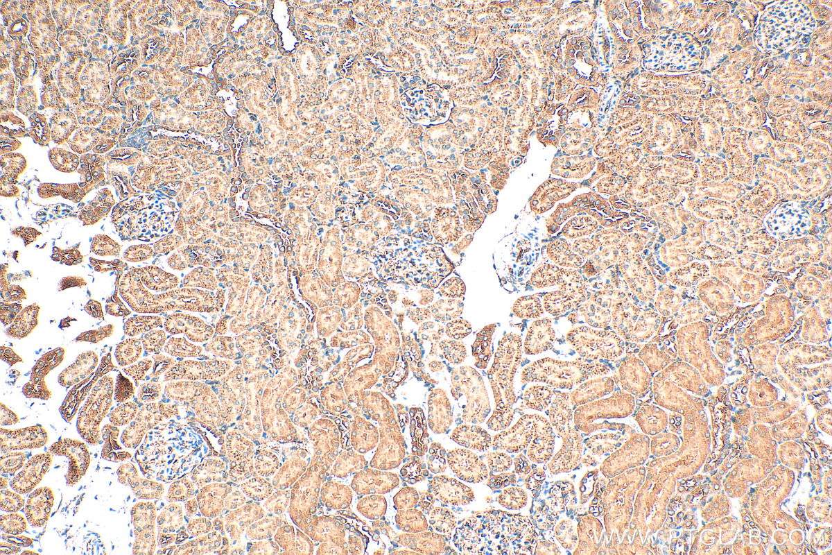 Immunohistochemistry (IHC) staining of rat kidney tissue using Alpha 1 Antitrypsin Polyclonal antibody (16382-1-AP)