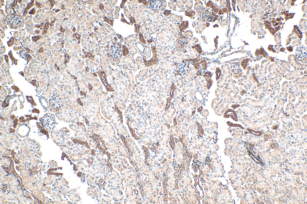 Immunohistochemistry (IHC) staining of mouse kidney tissue using Alpha 1 Antitrypsin Polyclonal antibody (16382-1-AP)