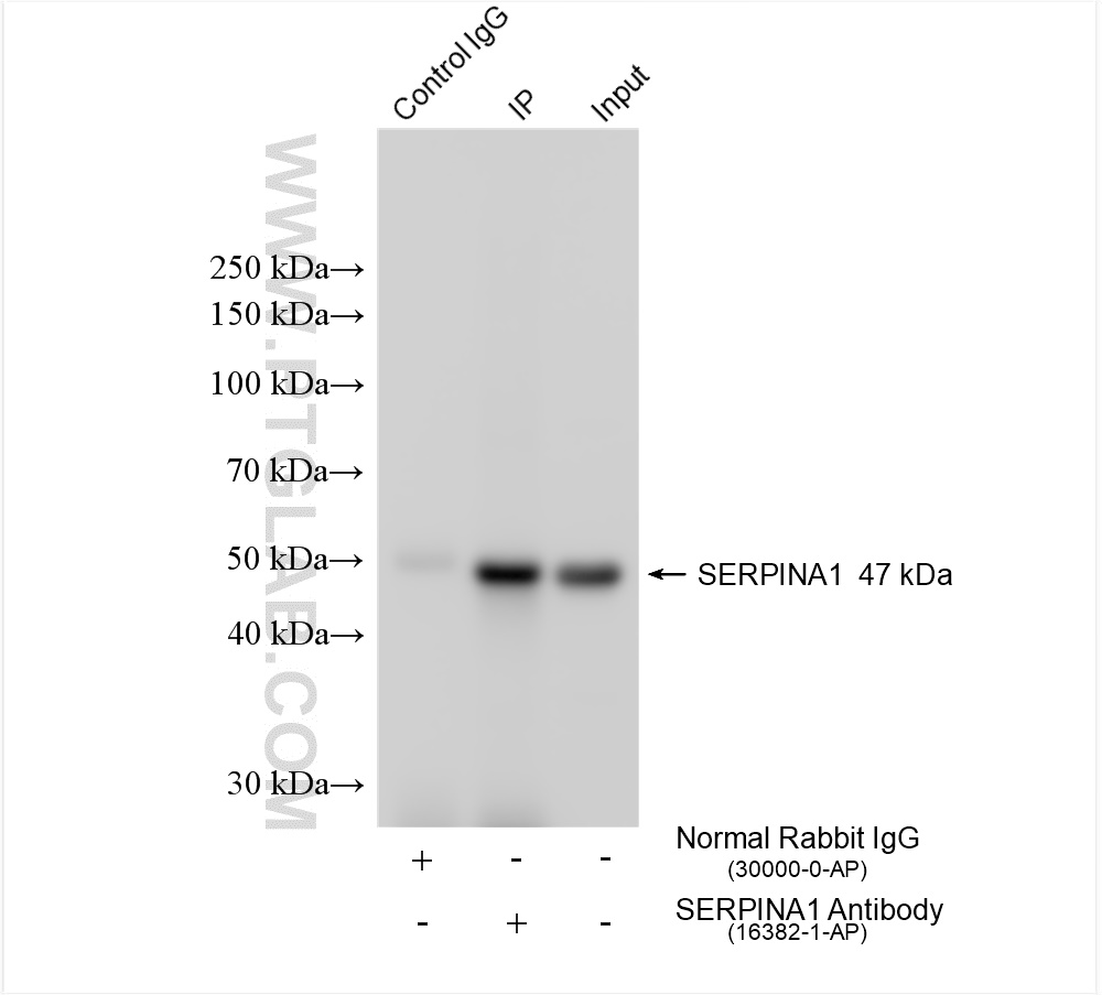 Immunoprecipitation (IP) experiment of mouse kidney tissue using Alpha 1 Antitrypsin Polyclonal antibody (16382-1-AP)