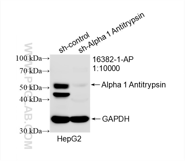 Western Blot (WB) analysis of HepG2 cells using Alpha 1 Antitrypsin Polyclonal antibody (16382-1-AP)