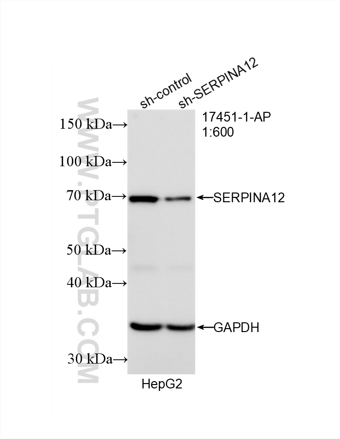 Western Blot (WB) analysis of HepG2 cells using Serpin A12/Vaspin Polyclonal antibody (17451-1-AP)