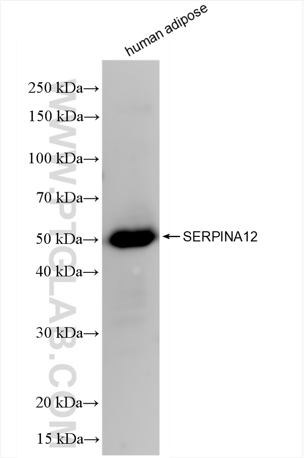 Western Blot (WB) analysis of human adipose tissue using Serpin A12/Vaspin Recombinant antibody (85908-5-RR)