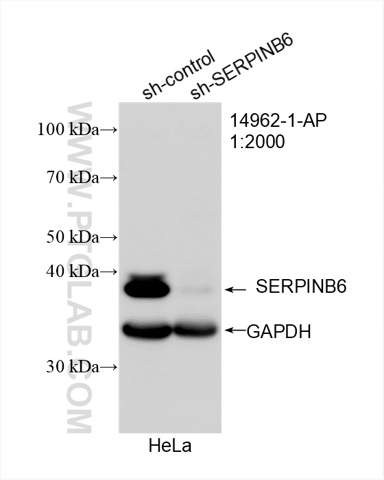 Western Blot (WB) analysis of HeLa cells using SERPINB6 Polyclonal antibody (14962-1-AP)