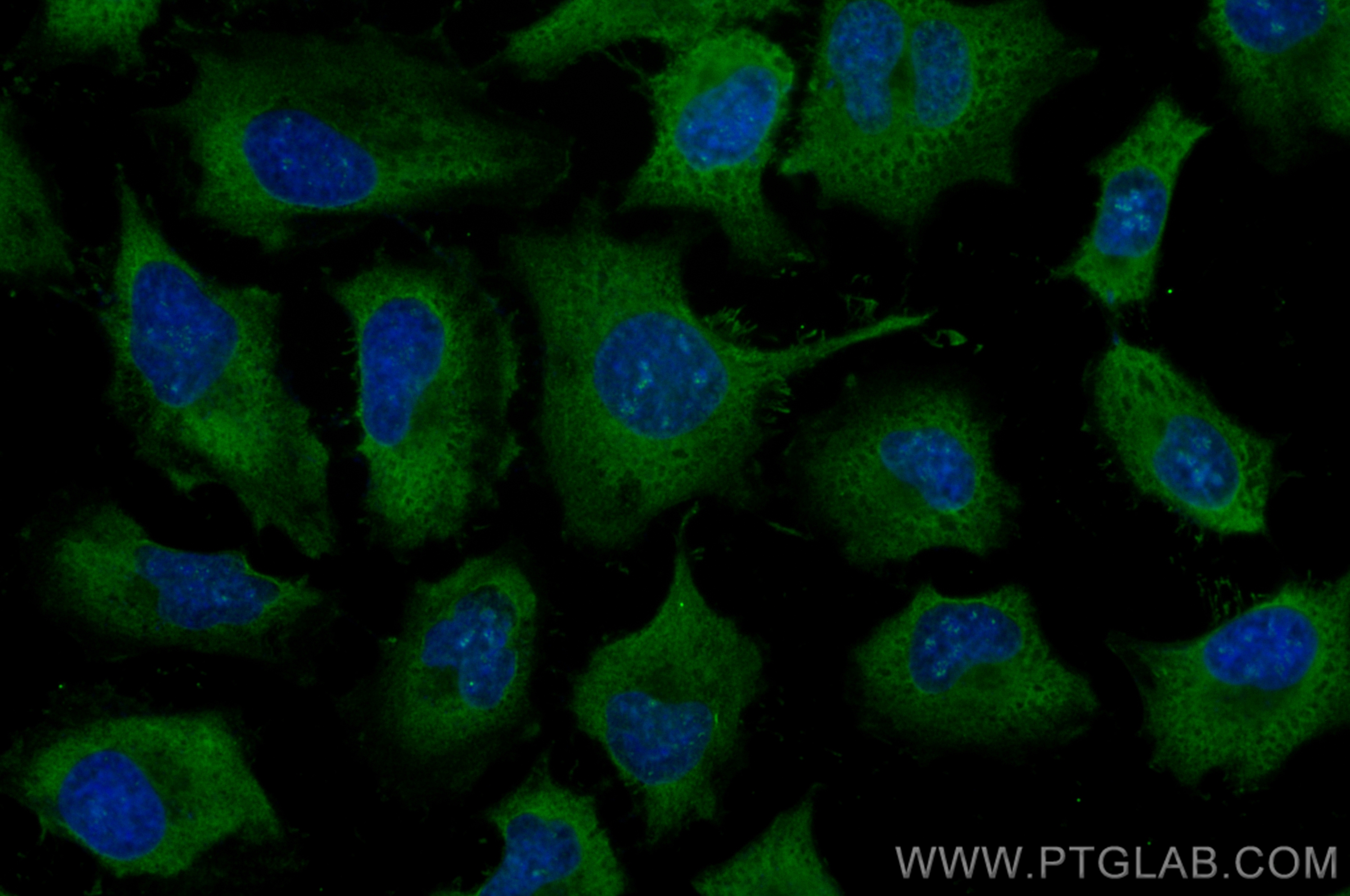 Immunofluorescence (IF) / fluorescent staining of HeLa cells using CoraLite® Plus 488-conjugated SERPINB9 Monoclonal  (CL488-67950)