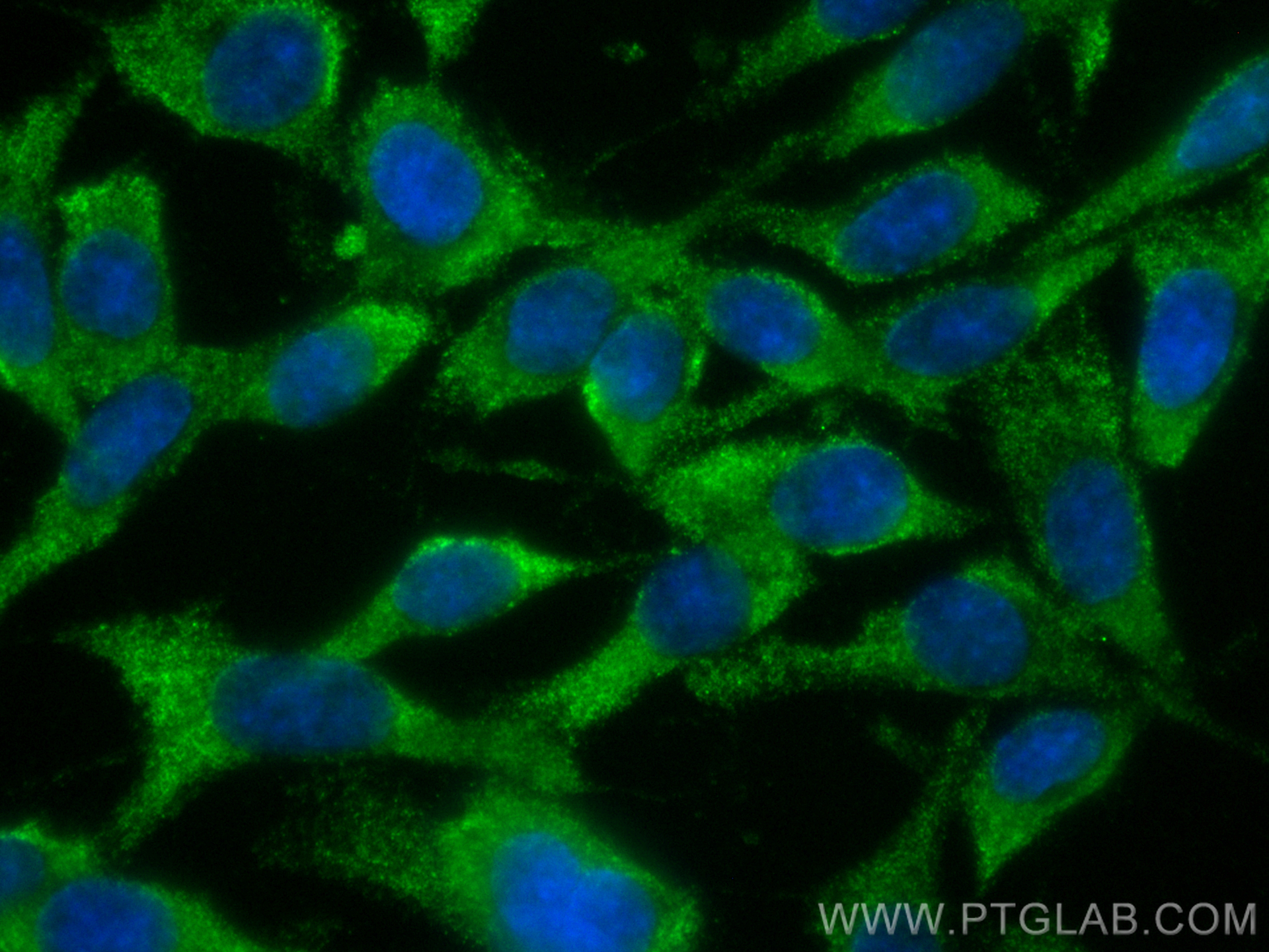 Immunofluorescence (IF) / fluorescent staining of C6 cells using CoraLite® Plus 488-conjugated SERPINB9 Monoclonal  (CL488-67950)