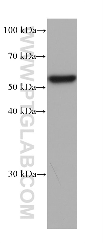 Western Blot (WB) analysis of human plasma using Serpin C1/Antithrombin III Monoclonal antibody (66052-1-Ig)