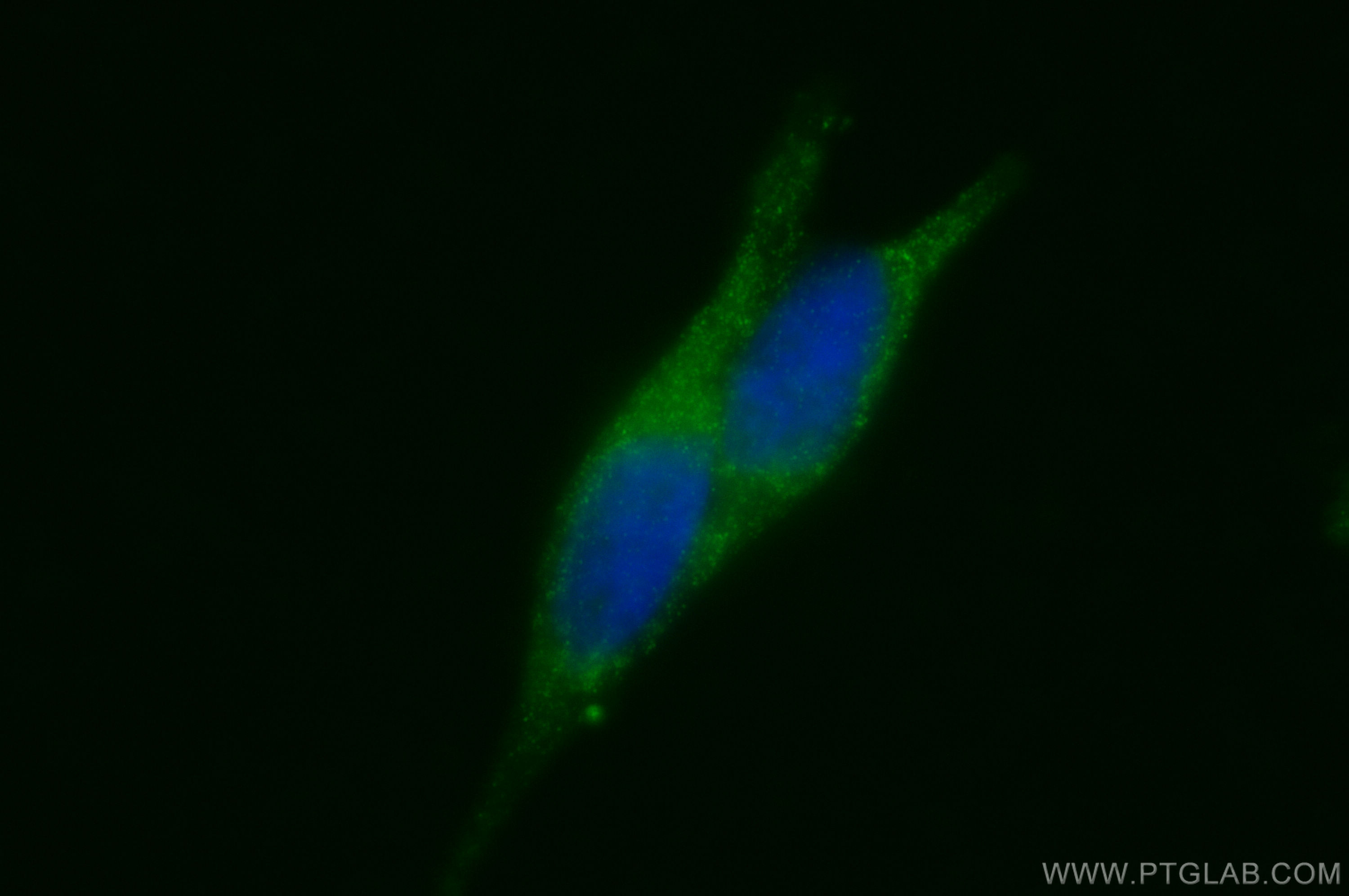 Immunofluorescence (IF) / fluorescent staining of LNCaP cells using PAI-1 Polyclonal antibody (13801-1-AP)