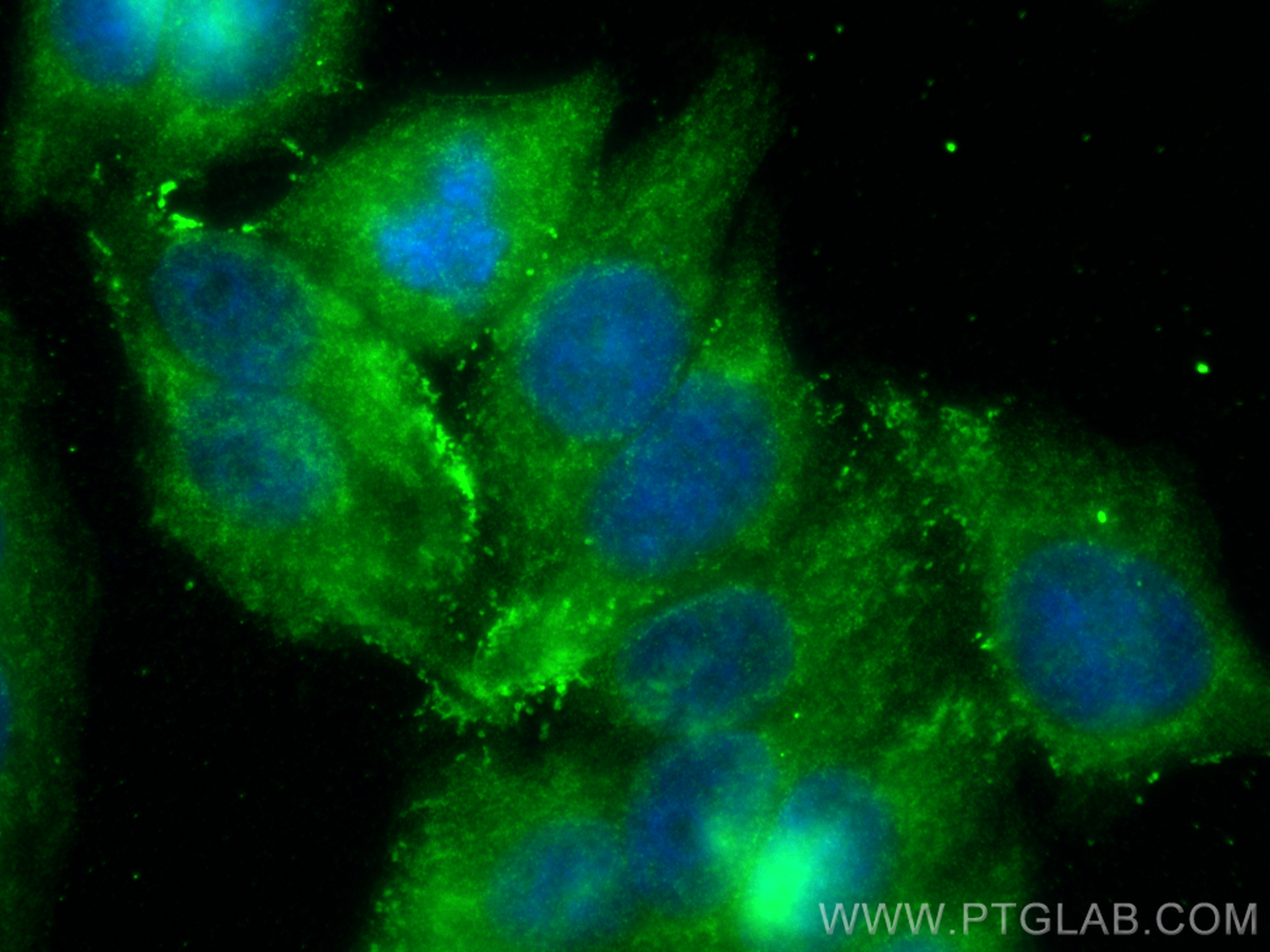 Immunofluorescence (IF) / fluorescent staining of HepG2 cells using Serpin E1/PAI-1 Polyclonal antibody (13801-1-AP)