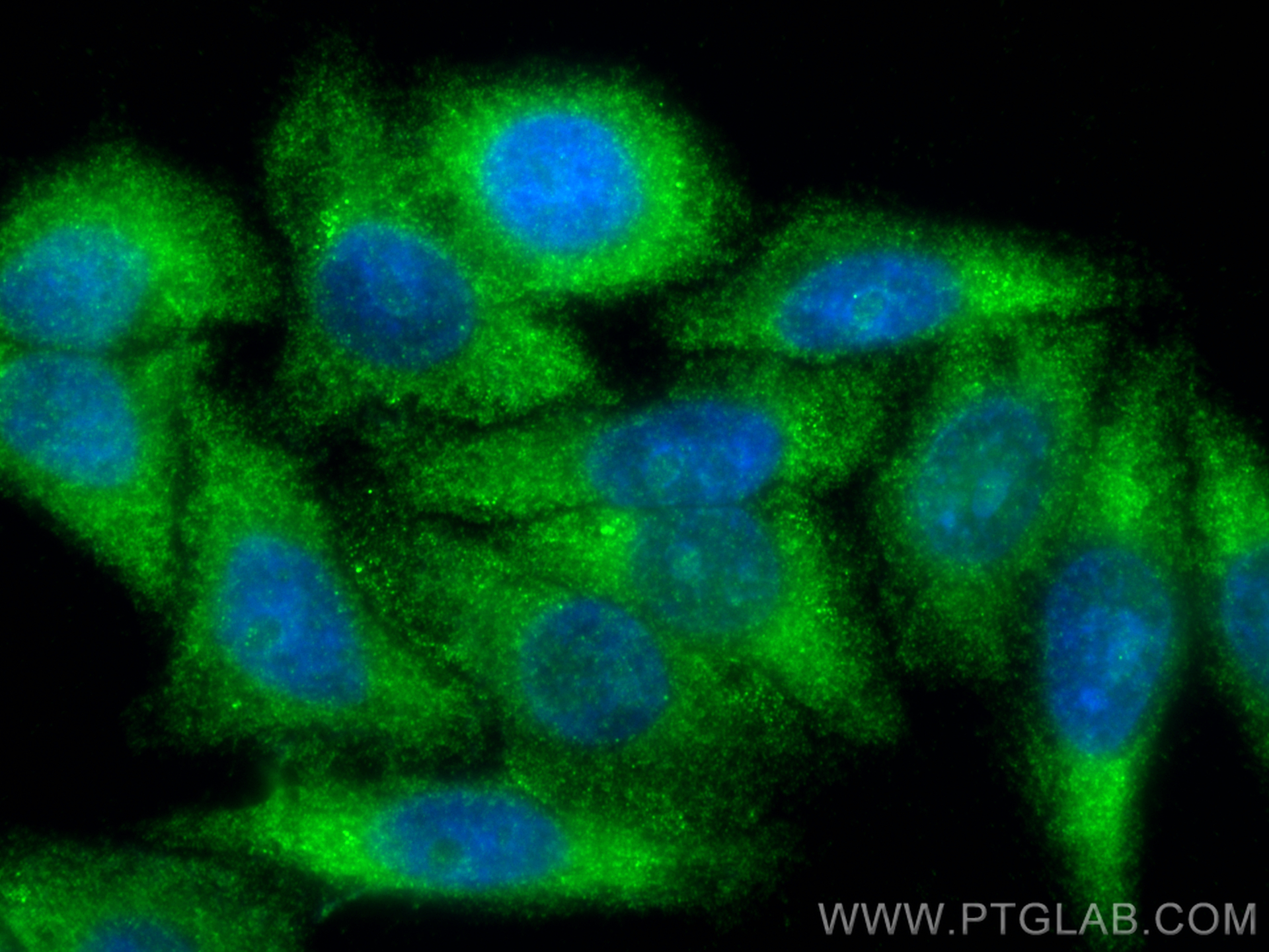 Immunofluorescence (IF) / fluorescent staining of HepG2 cells using Serpin E1/PAI-1 Polyclonal antibody (13801-1-AP)