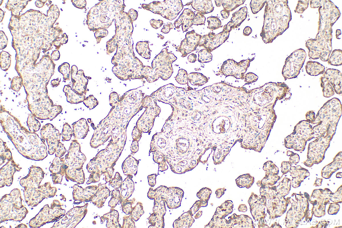 Immunohistochemistry (IHC) staining of human placenta tissue using Serpin E1/PAI-1 Polyclonal antibody (13801-1-AP)