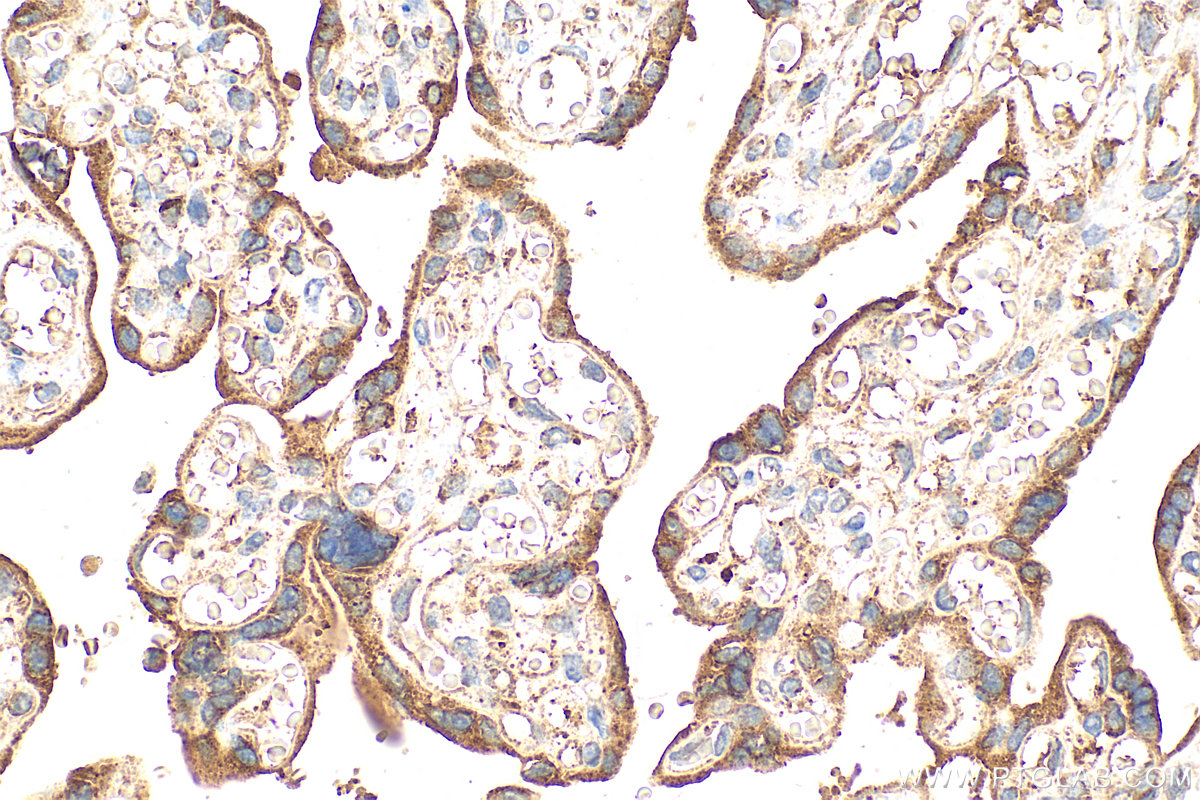 Immunohistochemistry (IHC) staining of human placenta tissue using Serpin E1/PAI-1 Polyclonal antibody (13801-1-AP)