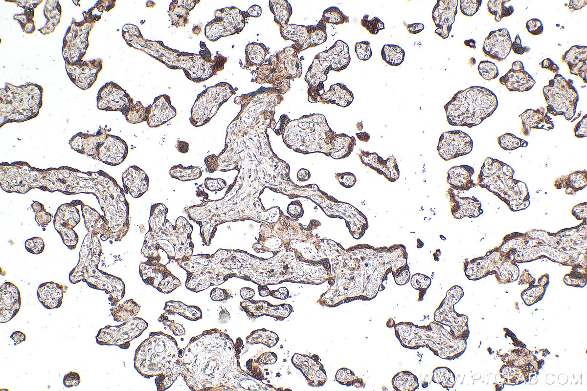 Immunohistochemistry (IHC) staining of human placenta tissue using Serpin E1/PAI-1 Polyclonal antibody (13801-1-AP)