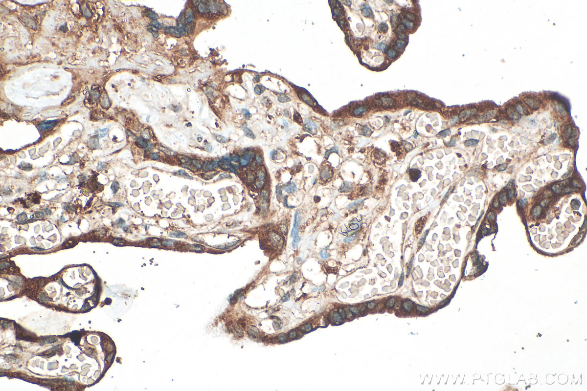 Immunohistochemistry (IHC) staining of human placenta tissue using Serpin E1/PAI-1 Polyclonal antibody (13801-1-AP)