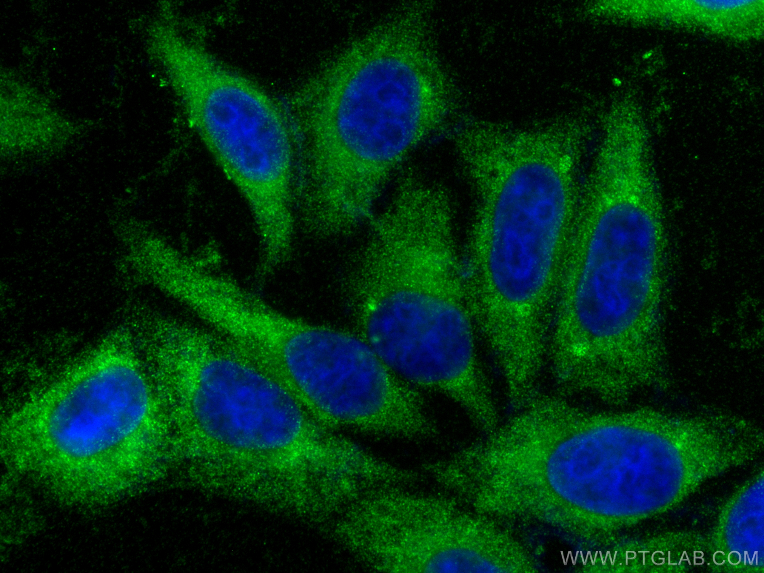 Immunofluorescence (IF) / fluorescent staining of HepG2 cells using Alpha 2-Antiplasmin Polyclonal antibody (13228-1-AP)