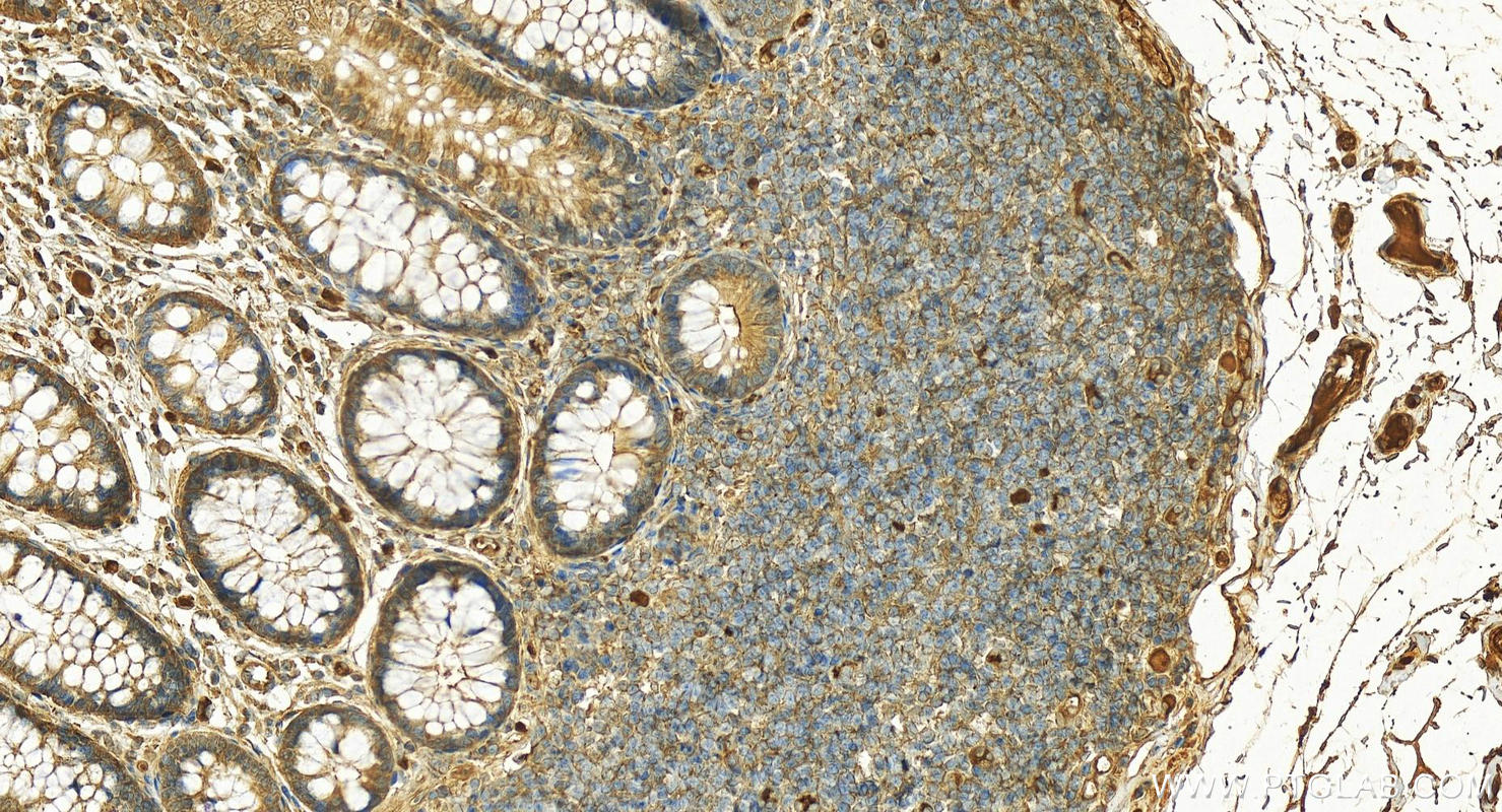 Immunohistochemistry (IHC) staining of human normal colon using SERPING1/C1 Inactivator Polyclonal antibody (12259-1-AP)