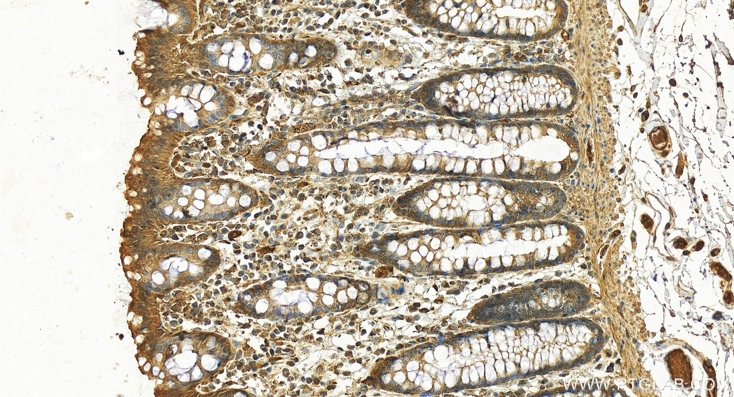 Immunohistochemistry (IHC) staining of human normal colon using SERPING1/C1 Inactivator Polyclonal antibody (12259-1-AP)