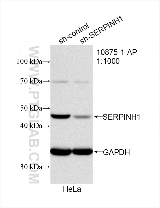 Western Blot (WB) analysis of HeLa cells using HSP47 Polyclonal antibody (10875-1-AP)