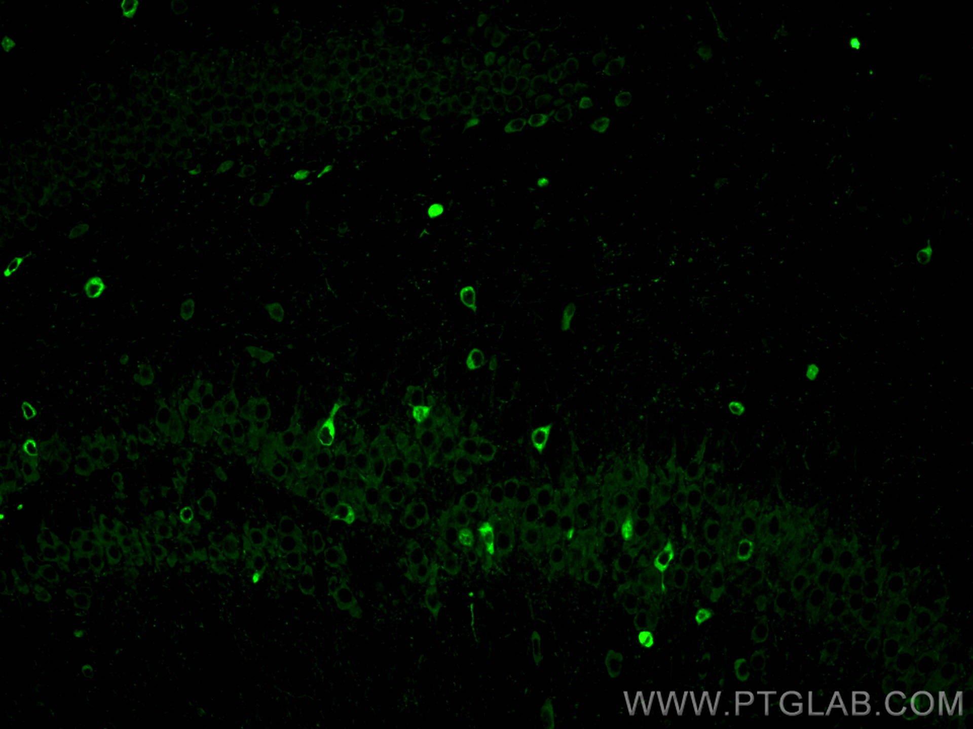 Immunofluorescence (IF) / fluorescent staining of mouse brain tissue using Neuroserpin Polyclonal antibody (12558-1-AP)