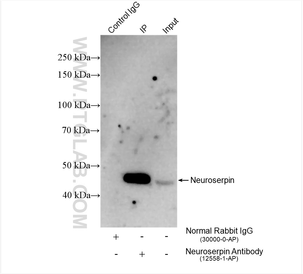 Immunoprecipitation (IP) experiment of rat brain tissue using Neuroserpin Polyclonal antibody (12558-1-AP)