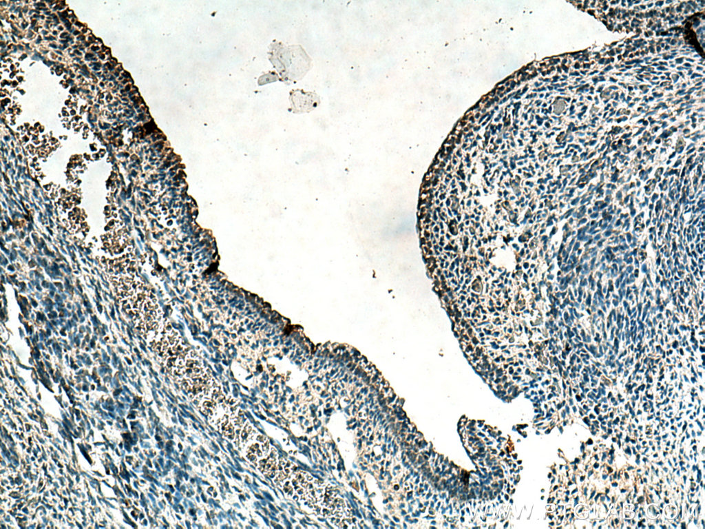 Immunohistochemistry (IHC) staining of mouse embryo tissue using SERTAD1 Polyclonal antibody (10167-1-AP)