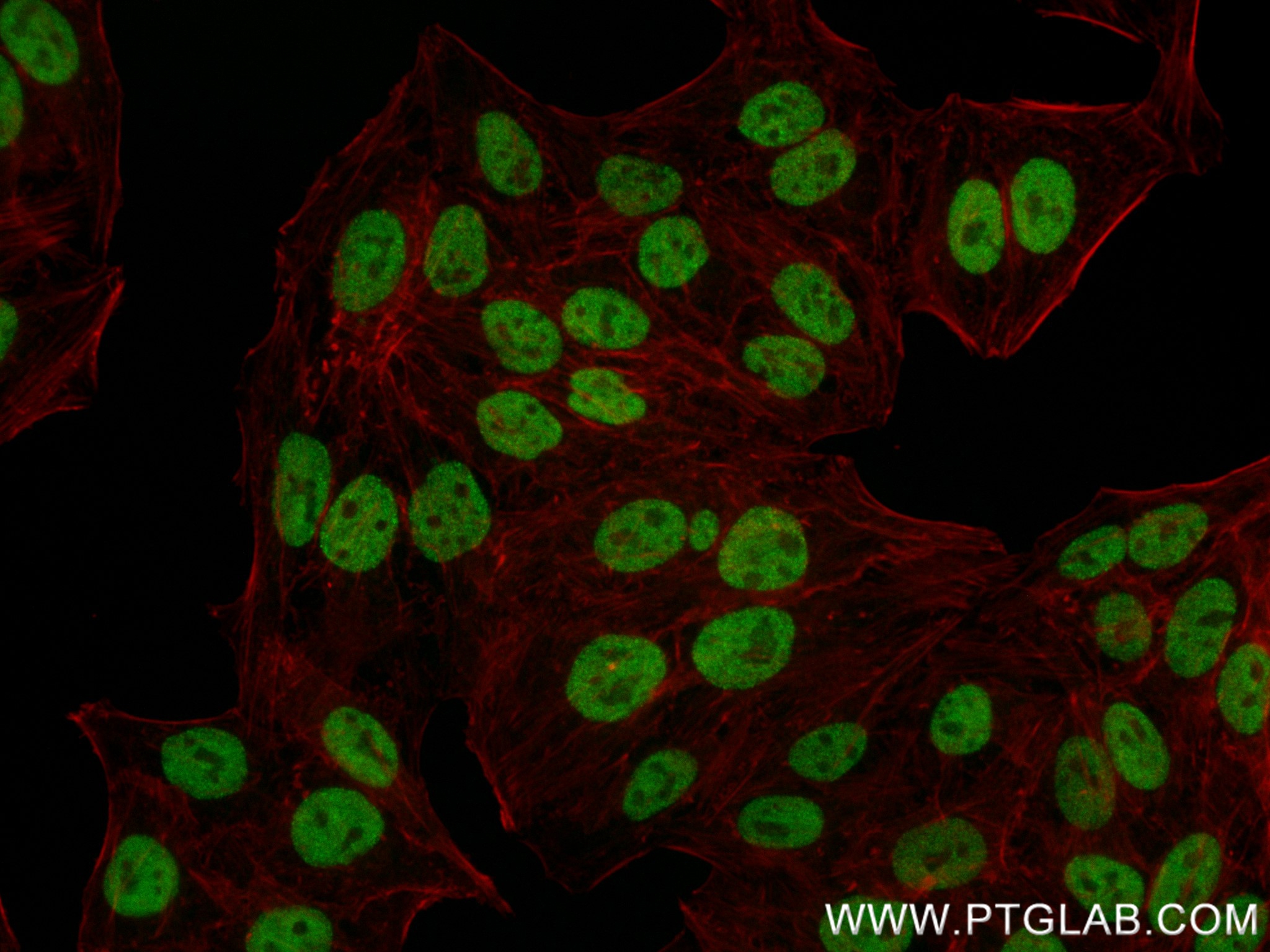 Immunofluorescence (IF) / fluorescent staining of HepG2 cells using SESN3 Recombinant antibody (84823-3-RR)