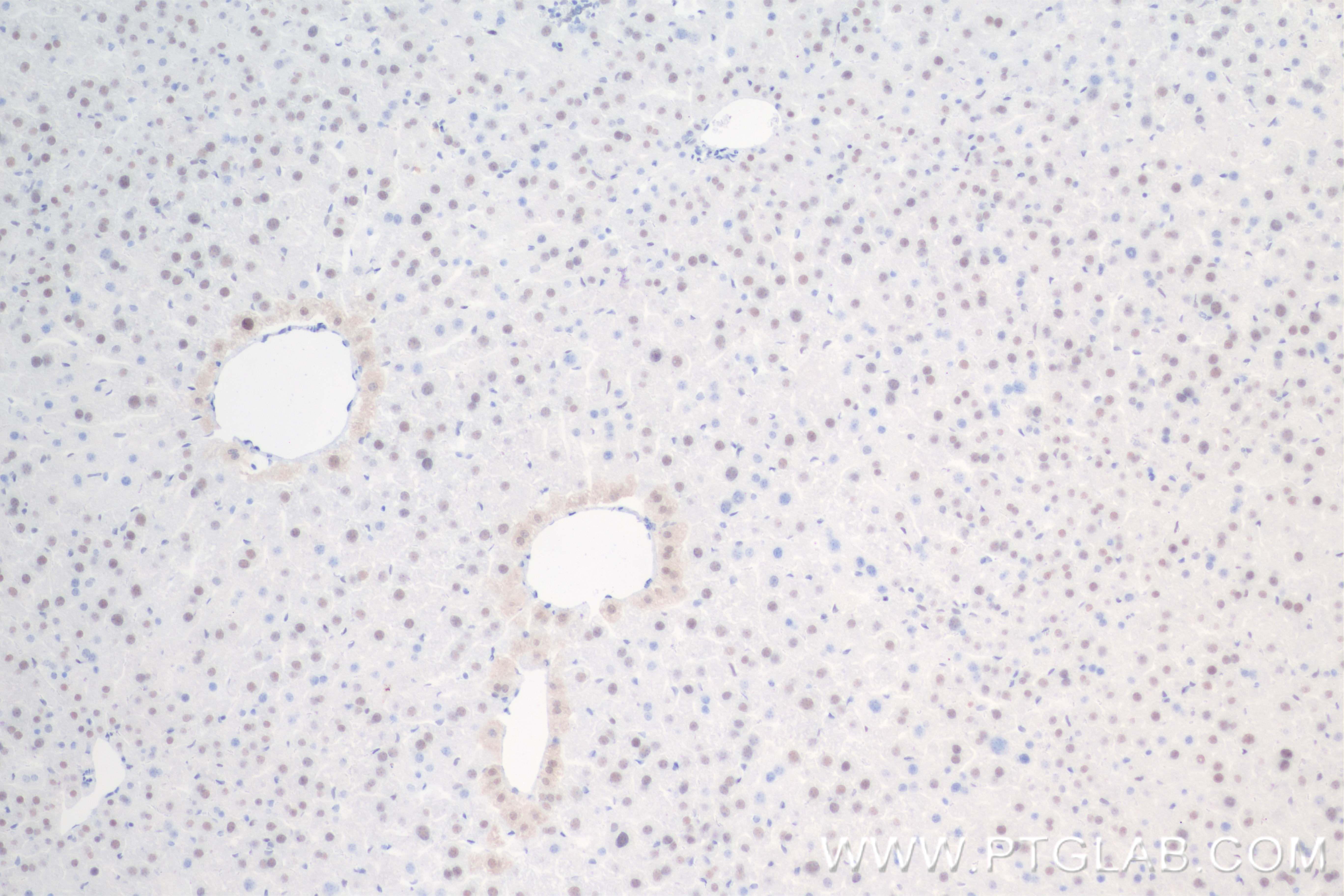 Immunohistochemistry (IHC) staining of mouse liver tissue using SESN3 Recombinant antibody (84823-3-RR)