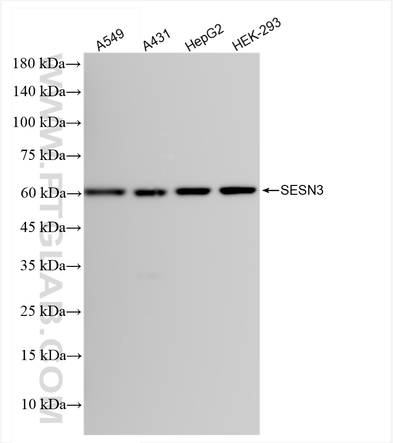 Western Blot (WB) analysis of various lysates using SESN3 Recombinant antibody (84823-3-RR)