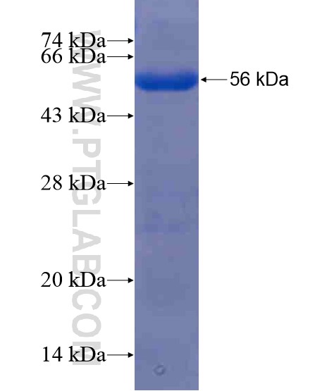 SESTD1 fusion protein Ag21010 SDS-PAGE