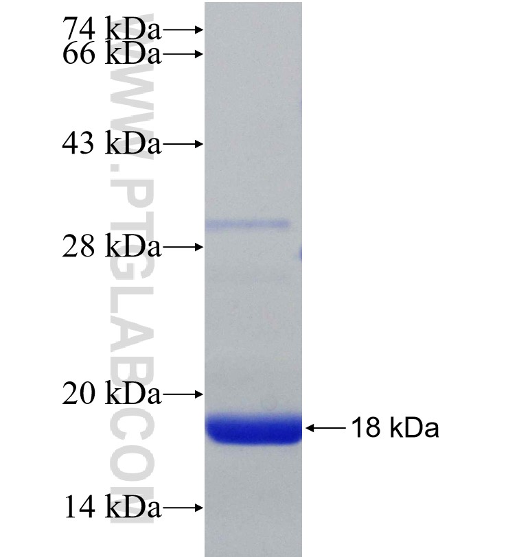 SETD3 fusion protein Ag30013 SDS-PAGE