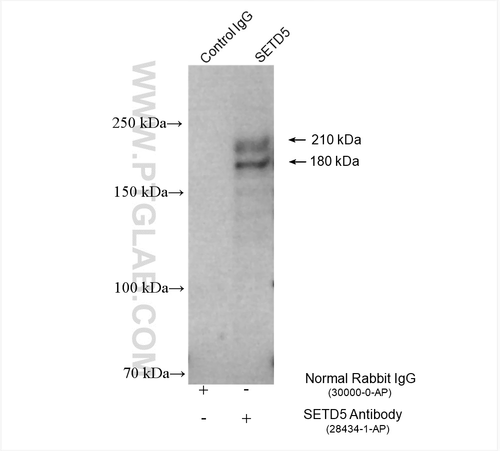 Immunoprecipitation (IP) experiment of BxPC-3 cells using SETD5 Polyclonal antibody (28434-1-AP)