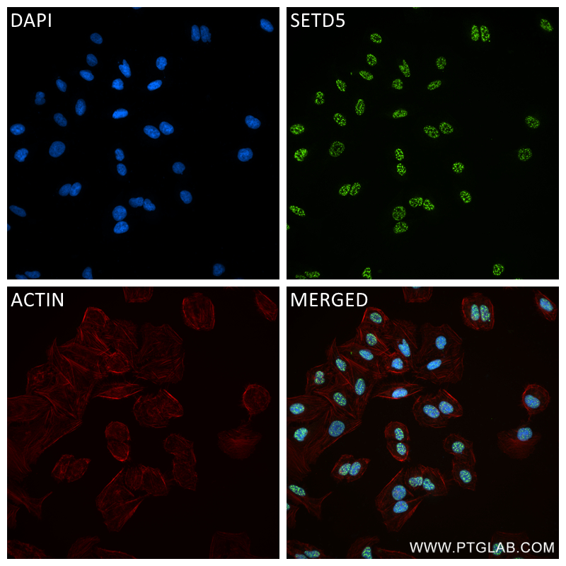 Immunofluorescence (IF) / fluorescent staining of U2OS cells using SETD5 Recombinant antibody (84622-1-RR)