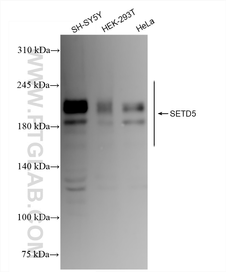 Western Blot (WB) analysis of various lysates using SETD5 Recombinant antibody (84622-4-RR)