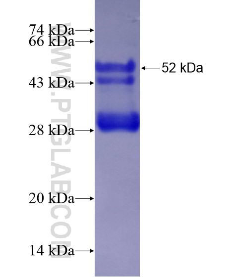 SETD5 fusion protein Ag28920 SDS-PAGE